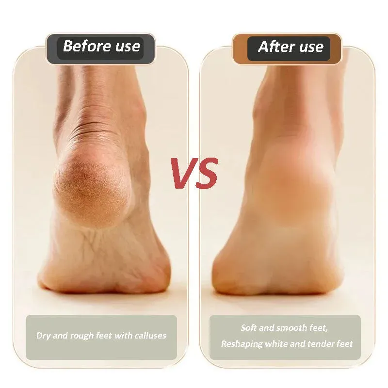 Hot ProductUSB Rechargeable Foot Repair and Grinding Device